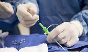 Interventional Cardiology